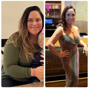 Carolina Before &Amp; Afters -