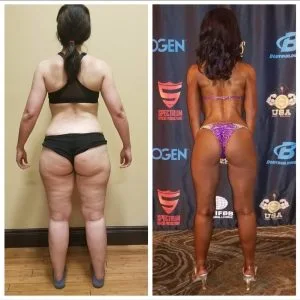 Carolina Before &Amp; Afters