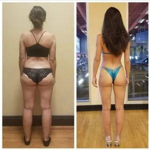 Carolina Before &Amp; Afters